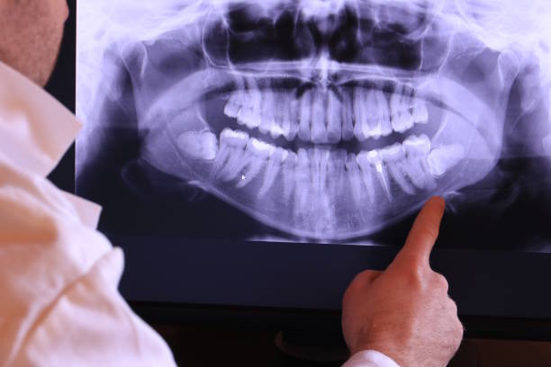Best Emergency Dental Care for Sports Injuries in Decatur, TN
